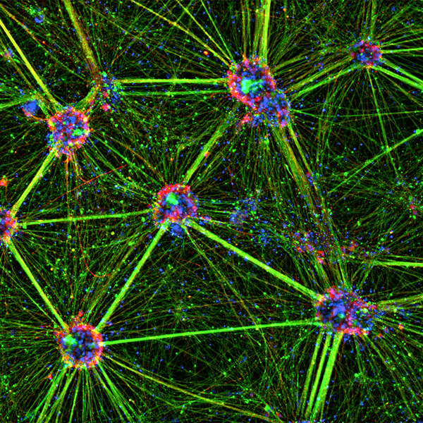 人多能干细胞衍生的交感神经元。在10倍拍摄图像，并为外围蛋白（绿色），酪氨酸羟化酶（红色）和DAPI（蓝色）染色。用Lionheart FX捕获的图像。佐治亚大学Hsueh Fu Wu的2021成像竞赛登顶