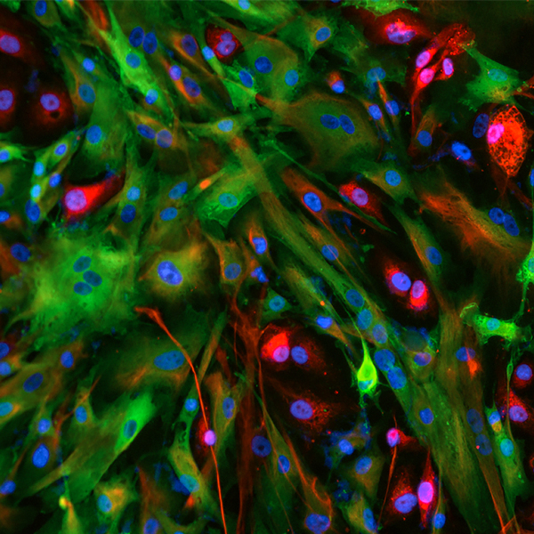器官腹膜组织模型，手动模式，10倍，DAPI，Calretinin Alexa-Fluor 488，Vimentin Alexa-Fluor 594，细胞跟踪器深红色，高级浆液卵巢癌细胞，粘附并破坏融合的黑纹层单层。捕获的图像：细胞3