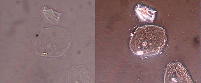 细胞的图像比较-左:亮场，右:相位对比