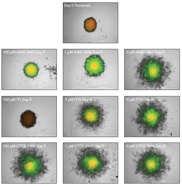 基于图像的MDA-MB-231/成纤维细胞肿瘤侵袭监测。
