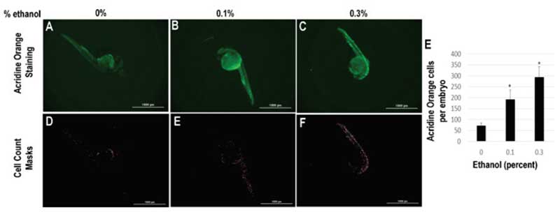 斑马鱼胚胎的细胞死亡在乙醇处理后以剂量依赖性的方式增加，可见GFP阳性细胞的数量。