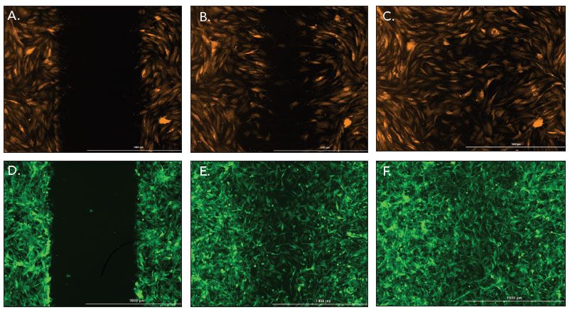 成纤维细胞和U-87伤口愈合的荧光图像。