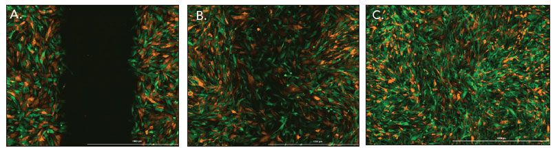 成纤维细胞和U-87共培养伤口愈合的荧光图像