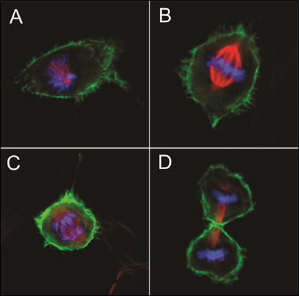 RPE1细胞在有丝分裂不同阶段的免疫荧光图像。