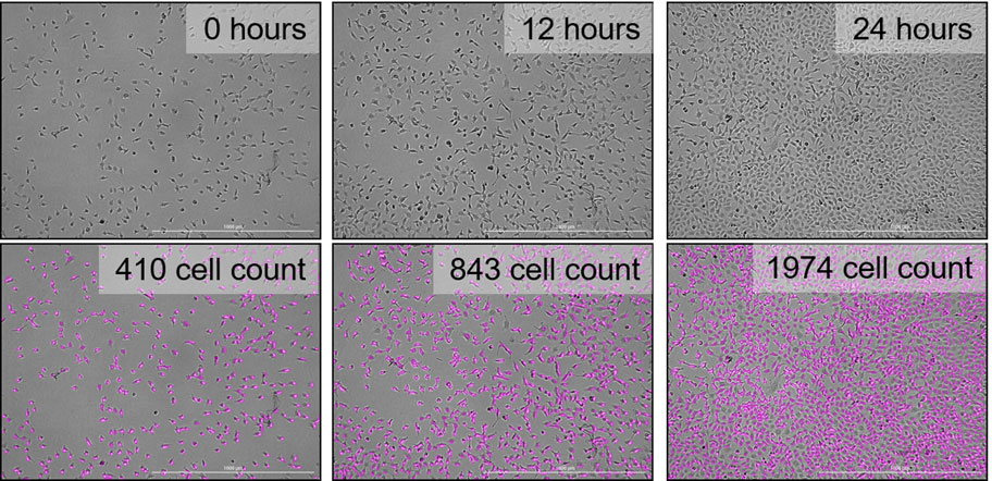 HC细胞计数和安捷伦BioTek Gen52022世界杯附加赛决赛图像分析工具提供无标签的细胞增殖随时间的量化。