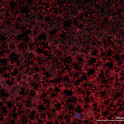 神经rest衍生的干细胞在荧光标记的心脏组织中
