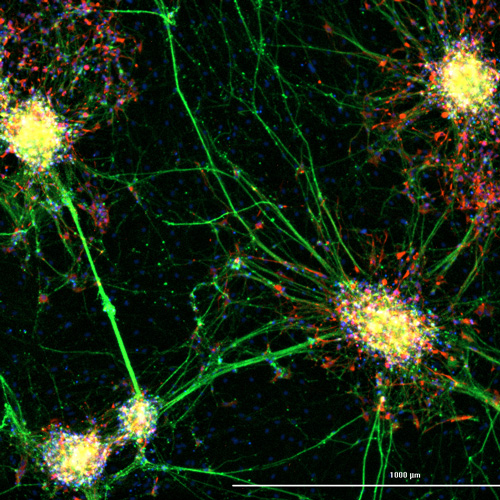 人IPSC衍生的神经祖细胞正在分化为神经元