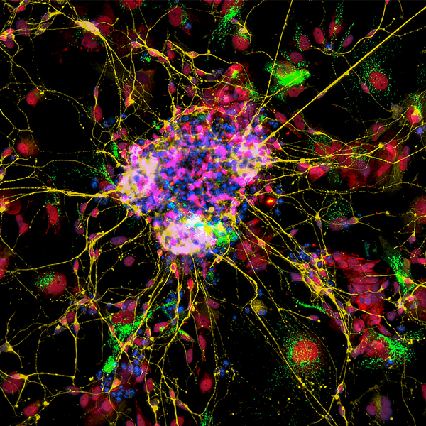 皮质神经元与用Tuj1（黄色），O-Glcnacylation（红色），线粒体（绿色）和DAPI染色的人多能干细胞区分开。使用自动图像处理以10倍放大倍率拍摄图像。