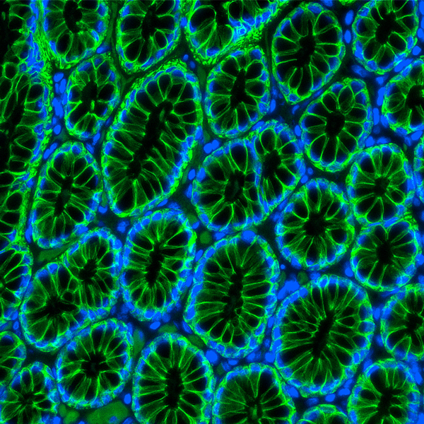 用eBioscience和Nuclei使用DAPI染色的人类胃上皮用Alexafluor 488偶联的抗胞素抗体（克隆AE1/AE3）染色。图像以20倍的放大倍数拍摄。由FundaciónArturoLópezPérez的Karina Cereceda提交了2021年成像竞赛。用细胞捕获的图像5。