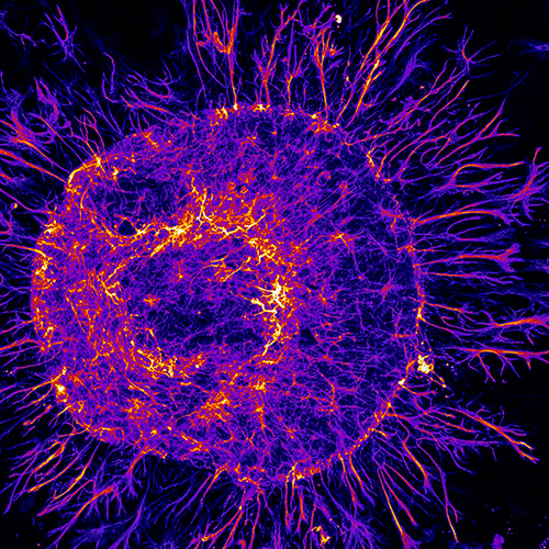 星形胶质细胞大鼠星形胶质细胞的火球标记为神经胶质纤维酸性蛋白。图像以20倍物镜为Z堆栈捕获，并通过最大荧光强度投影。
