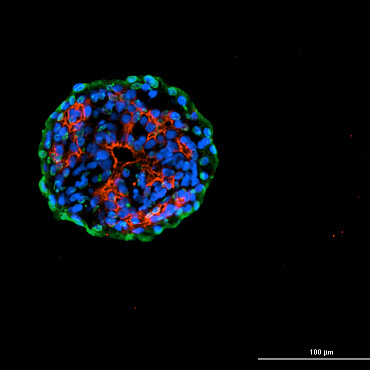 细胞角蛋白7（AlexaFluor®594）和Somatostatin（AlexaFluor®488），带有DAPI染色核的猪胰岛，成像为20倍。