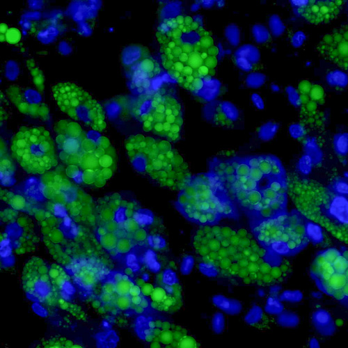 Simpson Golabi Behmel综合征（SGBS）脂肪细胞用Bodipy和Hoechst 33342染色。