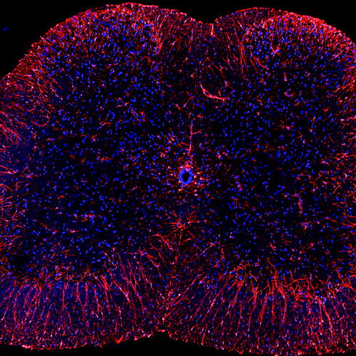 12个月大的大鼠脊髓标记为星形胶质细胞炎症标志物神经胶质纤维酸性蛋白（红色）。
