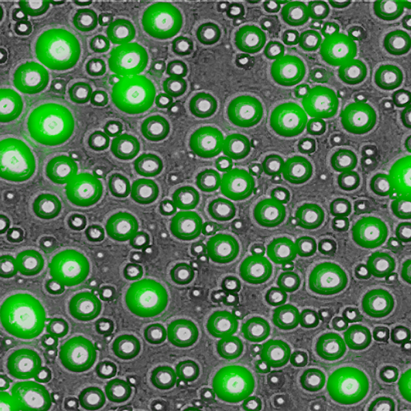 相分离的荧光素标记为下磷酸化的SRSF1，60倍，GFP/Brightfield叠加层。图片捕获的图像：伯明翰阿拉巴马大学的塔利亚·法尔加森（Talia Fargason）的Cytation 5