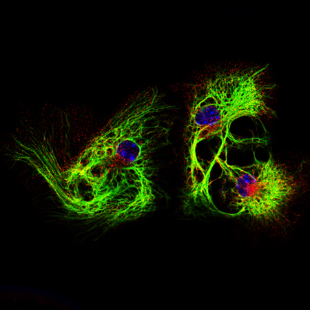 Ibrahim Halil Demirsoy干细胞衍生的神经细胞